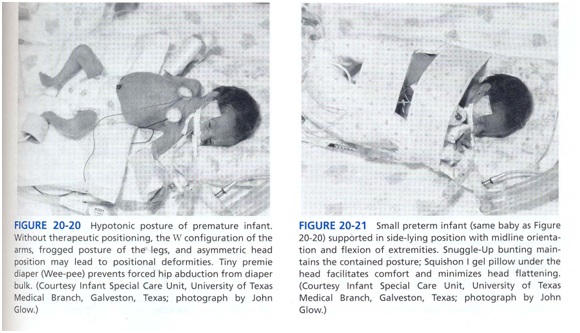 ارزيابي مراقبت هاي ويژة نوزادان ور در NICU صدا در NICU مراقبت در NICU نوزادان در NICU ماساژ نوزاد
محيط NICU نور در NICU صدا مراقبت نوزاد خانواده ها در كاردرمانی مراقبت ويژه نوزادان ماساژ نوزاد تحريك شنوايی تاخير حركتی کاردرمانی در nicu