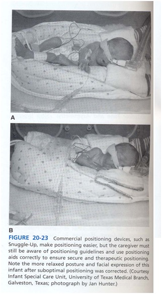 ارزيابي مراقبت هاي ويژة نوزادان ور در NICU صدا در NICU مراقبت در NICU نوزادان در NICU ماساژ نوزاد
محيط NICU نور در NICU صدا مراقبت نوزاد خانواده ها در كاردرمانی مراقبت ويژه نوزادان ماساژ نوزاد تحريك شنوايی تاخير حركتی کاردرمانی در nicu