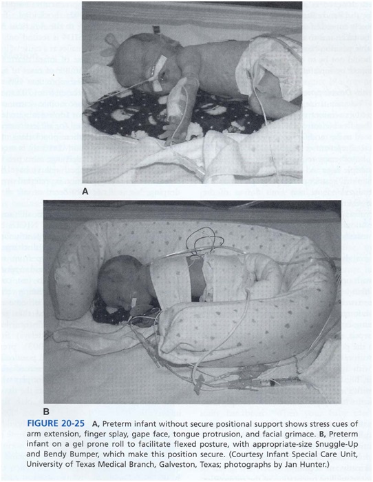 ارزيابي مراقبت هاي ويژة نوزادان ور در NICU صدا در NICU مراقبت در NICU نوزادان در NICU ماساژ نوزاد
محيط NICU نور در NICU صدا مراقبت نوزاد خانواده ها در كاردرمانی مراقبت ويژه نوزادان ماساژ نوزاد تحريك شنوايی تاخير حركتی کاردرمانی در nicu