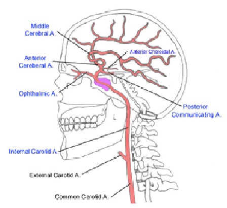 علائم و درمان كامل سكته مغزی خفيف و شديد
سکته مغزی در اصطلاح پزشکی: cva مخفف چیست؟
Cerebro  vascular accident or CVA
  سکته مغزی به انگلیسی  استروک (Stroke)
سکته مغزی خفیف یا گذرا (ایسکمیک(
علائم و درمان سکته خفیف مغزی (TIA)
دلایل سکته مغزی خفیف یا گذرا
راه های درمان سکته مغزی گذرا
کاردرمانی
کاردرمانی سکته مغزی در خانه
ورزشهای مخصوص سکته مغزی
تاثیر کاردرمانی در سکته مغزی
مرکز کاردرمانی سکته مغزی
بهترین دکتر برای سکته مغزی در تهران
بیمارستان تخصصی سکته مغزی در تهران
بهترین مرکز درمان سکته مغزی
توانبخشی بیماران سکته مغزی
کاردرمانی بیماران سکته مغزی
کاردرمانی در منزل بیمار سکته مغزی
بهترین مرکز توانبخشی سکته مغزی
بهترین دکتر برای سکته مغزی در تهران
تمرینات کاردرمانی سکته مغزی
مراقبت پرستاری cva
مراقبت از بیمار سکته مغزی در منزل
آب درمانی
خارج کردن لخته خون
تحریک الکتریکی مغز (TDCS)
بهترین دارو برای بیماران سکته مغزی
