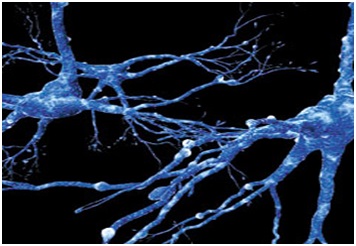 علائم و درمان كامل سكته مغزی خفيف و شديد
سکته مغزی در اصطلاح پزشکی: cva مخفف چیست؟
Cerebro  vascular accident or CVA
  سکته مغزی به انگلیسی  استروک (Stroke)
سکته مغزی خفیف یا گذرا (ایسکمیک(
علائم و درمان سکته خفیف مغزی (TIA)
دلایل سکته مغزی خفیف یا گذرا
راه های درمان سکته مغزی گذرا
کاردرمانی
کاردرمانی سکته مغزی در خانه
ورزشهای مخصوص سکته مغزی
تاثیر کاردرمانی در سکته مغزی
مرکز کاردرمانی سکته مغزی
بهترین دکتر برای سکته مغزی در تهران
بیمارستان تخصصی سکته مغزی در تهران
بهترین مرکز درمان سکته مغزی
توانبخشی بیماران سکته مغزی
کاردرمانی بیماران سکته مغزی
کاردرمانی در منزل بیمار سکته مغزی
بهترین مرکز توانبخشی سکته مغزی
بهترین دکتر برای سکته مغزی در تهران
تمرینات کاردرمانی سکته مغزی
مراقبت پرستاری cva
مراقبت از بیمار سکته مغزی در منزل
آب درمانی
خارج کردن لخته خون
تحریک الکتریکی مغز (TDCS)
بهترین دارو برای بیماران سکته مغزی
