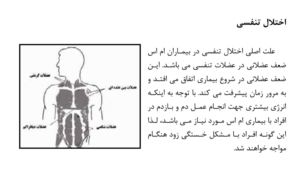 اختلال تنفسی ام اس