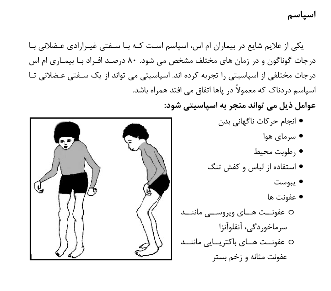 اسپاسم سفتی ام اس 