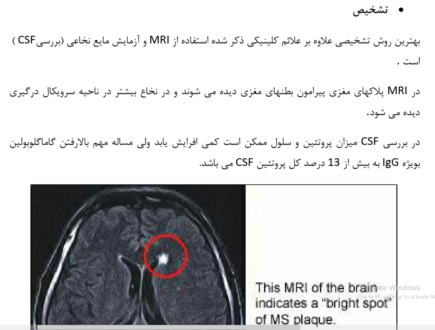 تشخيص ام اس