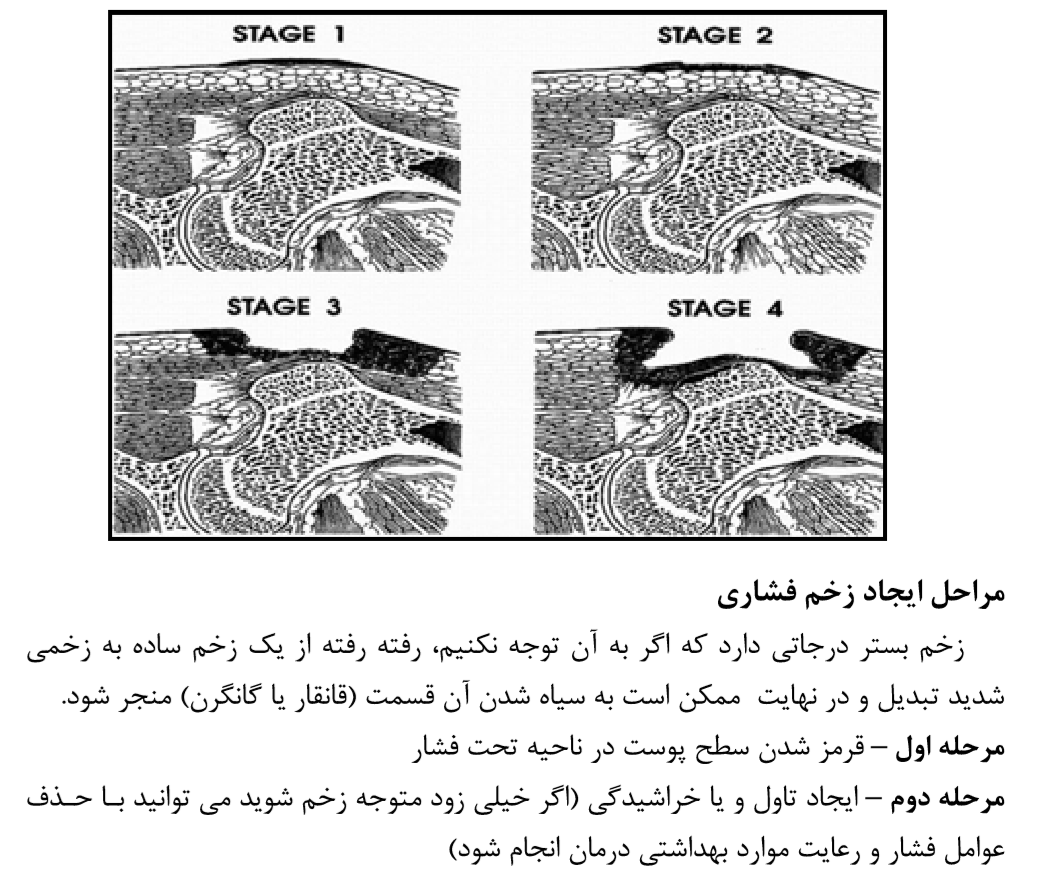 زخم بستر ام اس 